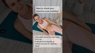 C-section scar mobility check #csectionmom #csectionmom #cesareansection #scarmobility #fascias