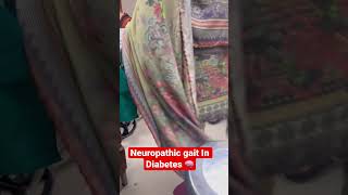 Diabetic Neuropathic Gait/ High Steppage Gait #neurology #viral #shortsyoutube #diabetes #shorts