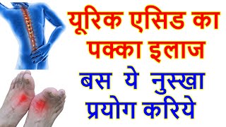 यूरिक एसिड का घरेलू इलाज | यूरिक एसिड का रामबाण इलाज |  Home Remedies for Uric Acid | Nuskhe