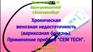 2007 Варикоз и аппарат СЕМ ТЕСН Засыпкина И.Н.