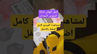 الحل النهائى لإزالة الرؤوس السوداء