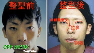 日本通緝犯躲警察 「自己整型」，被捕還帥到爆紅｜日本超扯真實案件