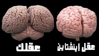 لماذا يختلف دماغ أينشتاين عن دماغك ؟ لماذا كان مميزًا ؟