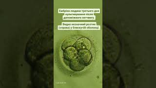 A human embryo on the third day of cultivation. Ембріон людини третього дня культивування. #icsi