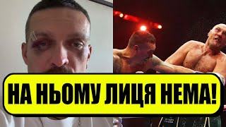 ЗСУ, ЗВЕРТАЮСЬ ДО ВАС! Усик розірвав ефір: ВПЕРШЕ після бою-ого зізнання, гляньте в якому він стані!