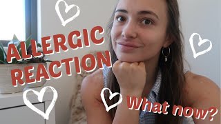 Skin Update | Allergic reaction | What did I learn?