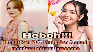 Tak disangka! Kecantikan Amanda tak bisa disaingi oleh Anne