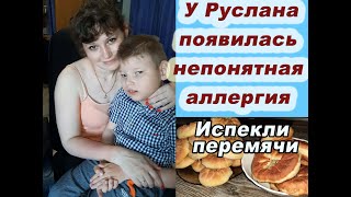 У Руслана непонятная  аллергия/Татарские перемячи