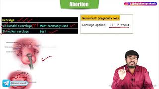 Abortion ( Part - 2 ) : Obstetrics and Gynaecology Lecture