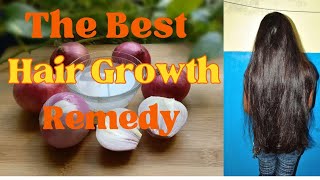 The Best Hair Growth Remedy| onion  juice for hair growth| Hair loss Growth | Gayana | Hamsa Yoga