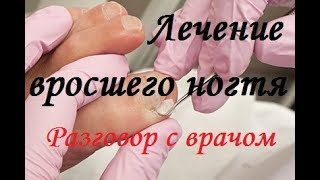 Лечение вросшего ногтя. Разговор с врачом