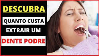 QUANTO CUSTA PARA EXTRAIR UM DENTE PODRE?