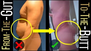 BodyBanking®  to the Chest and Glutes | From Gut to the Butt | Male Plastic Surgery