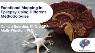 Functional Mapping in Epilepsy Using Different Methodologies