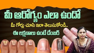 10 NAIL SIGNS of HEALTH PROBLEMS | Black & Red Nail Problems | Nail Diseases | Dhatri Health