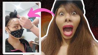 DISASTER! My TURKEY hair restoration surgery story | Opt into Beauty