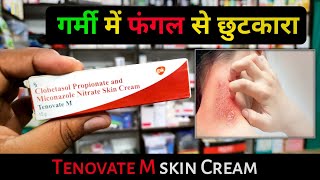 इस क्रीम से फंगल जड़ से खत्म ⚡ | tenovate m cream | best fungal infection cream | Medical Jankari