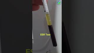 ESR test | high ESR | erythrocyte sedimentation rate #medicallaboratory #bloodtest #medicallab