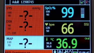 SureSigns VS2 Alarms