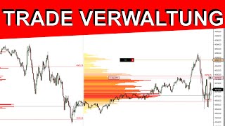 Trade Verwaltung, mal was ganz anderes | Institutionelles Trading