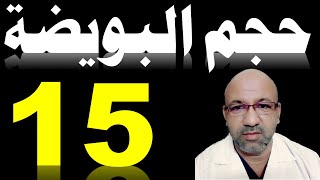 حجم البويضة 15 مناسب للحمل | حجم البويضة المناسب للحمل دكتور يوسف عيد