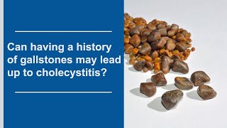 History of Gallstones May Lead Up to Cholecystitis | Healthie Genie