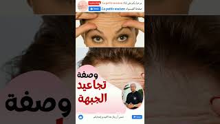 وصفة تجاعيد الجبهة الدكتور عماد ميزاب Docteur Imad Mizab #short #shortvideo #shortsvideo