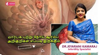 மார்பக புற்று நோய் ஆரம்ப அறிகுறிகள் எப்படி இருக்கும்?| Dr Jeyarani Kamaraj | Aakash Fertility Centre