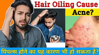 Hair Oiling Causes Acne ? | हेयर ऑइलिंग के कारण मुंहासे होते हैं ?