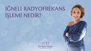 İğneli Radyofrekans İşlemi Nedir?