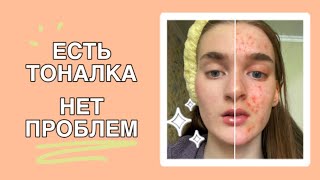 как ПРАВИЛЬНО нанести ТОН на проблемную кожу 😲 | секрет невесомого покрытия |