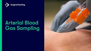 Arterial Blood Gas (ABG) Sampling | Everything You Need to Know to Perform this Vital Procedure