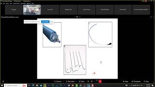 conductive system pacing   Dr  Mohamed Mousa