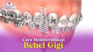 CARA MEMBERSIHKAN BEHEL GIGI YANG BAIK DAN BENAR