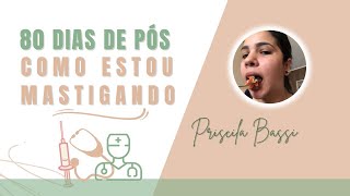 Já dá pra mastigar com 80 dias de Pós operatório? | Cirurgia Ortognática Pós Op.