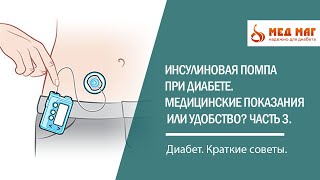 Инсулиновая помпа при диабете. Медицинские показания или удобство?