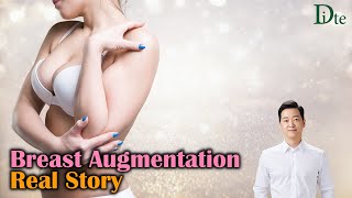 Interview with Breast Augmentation Surgery Model | Plastic Surgery | Breast Augmentation