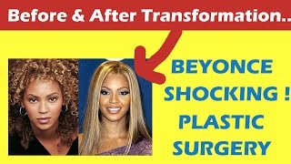 Beyonce Plastic Surgery Before and After Full HD