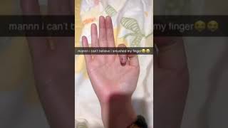 Bro casually has 6 fingers #funnyshorts #shorts #memes #skinwalker