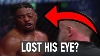 1 punch ended his MMA career 😱 CRAZY STORY  #viral