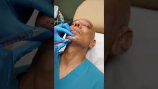 Vollure Chin Enhancement from Genesis Plastic Surgery and Medical Spa