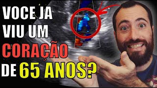 Como é o coração humano? e o coração por dentro? ja viu o coração batendo? Voce vai se ENCANTAR !