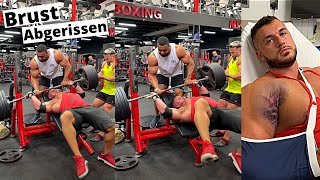 150 Kg BODYBUILDER Brustmuskel GERISSEN !!  Larry Wheels Trainingspartner.