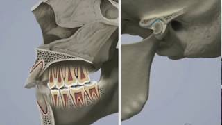 Sintomi malocclusione