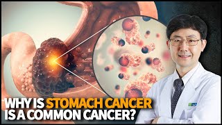 Why is Stomach Cancer is common cancer? How do we diagnose and treat Gastric Cancer in general?