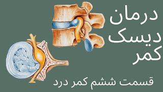 درمان دیسک کمر با  4 تمرین ساده  یوگا در خانه | فتق دیسک کمر با یوگا درمان میشه.