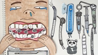 [🚀paper diy] 역대급 충치 치료 ASMR 🦷 치과놀이 Dental Care, Cavity Removal, Resin 🔇No music