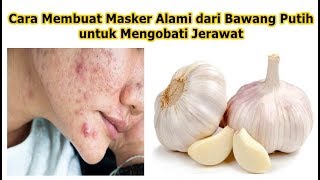 Cara Membuat Masker Alami dari Bawang Putih untuk Mengobati Jerawat