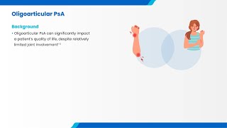 Treatment of early oligoarticular psoriatic arthritis with apremilast: the FOREMOST trial