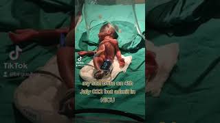 my son born on 4th July 022 but admit in NICU